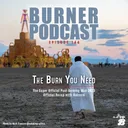 The Burn You Need artwork