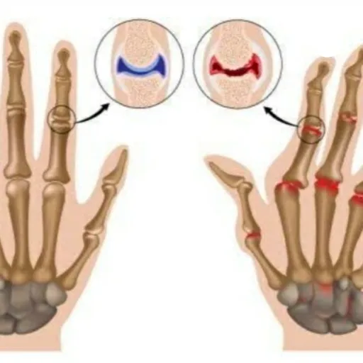 Fisioterapia reumatologica Artwork