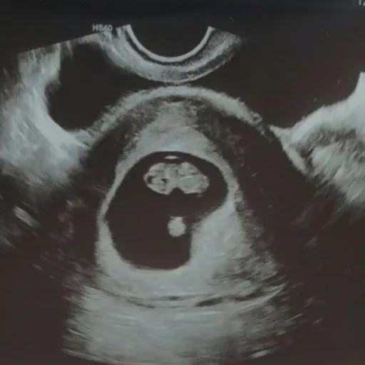Miscarriages(Basic) Artwork